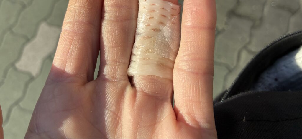 介護者の私が階段から転落して頭を打ち・靴下のことを考えた話