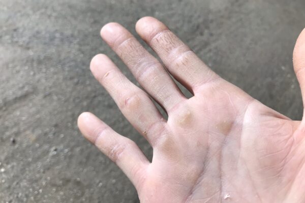 保護中: 仕事中でも繰り返し襲ってくる希死念慮が治らない・勉強できない